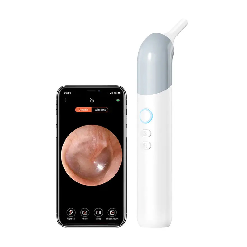 Pet Ear Cleaner - HD Kameralı 3'ü 1 Arada Akıllı