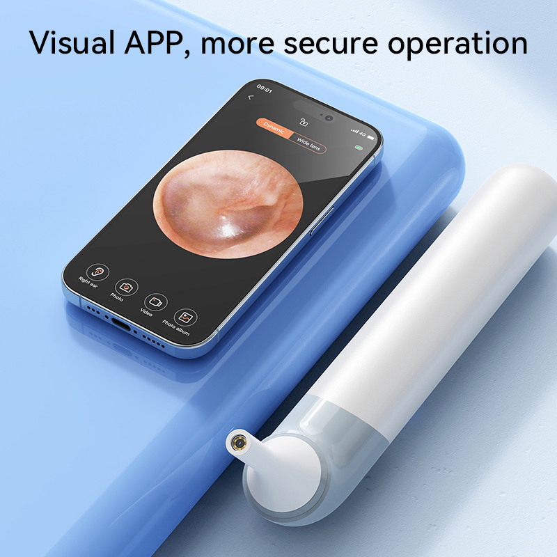 HD Kameralı 3'ü 1 Arada Akıllı - Pet Ear Cleaner incelemesi ve fiyatı